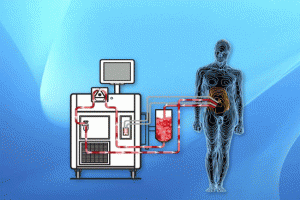Illustration of heated chemo therapy