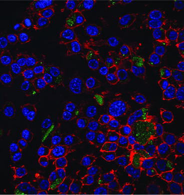 Macrophages with blue nuclei and red cytoskeletons, being treated with green nano particles. The particles carry RNA that shut off reactive oxygen species production.