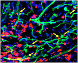 Transplanted cells were labeled with a red dye, while a perfused green dye shows the extent of functional blood vessels. Blue is DAPI, staining nuclear DNA. Yellow arrows indicate where red cells appear to contribute to blood vessels.
